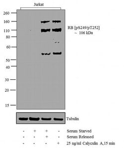 Invitrogen Phospho-Rb (Ser249, Thr252) Polyclonal Antibody 100 &mu;L; Unconjugated:Antibodies,