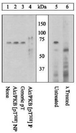 Invitrogen Phospho-AKT1 (Thr308) Polyclonal Antibody 100 &mu;L; Unconjugated:Antibodies,