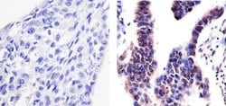 Invitrogen Phospho-PYK2 (Tyr402) Polyclonal Antibody 100 &mu;L; Unconjugated:Antibodies,