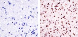 Invitrogen Phospho-PYK2 (Tyr402) Polyclonal Antibody 100 &mu;L; Unconjugated:Antibodies,
