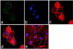 Invitrogen Phospho-FAK (Tyr861) Polyclonal Antibody 100 &mu;L; Unconjugated:Antibodies,