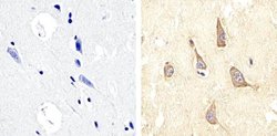 Invitrogen Phospho-PYK2 (Tyr579, Tyr580) Polyclonal Antibody 100 &mu;L;