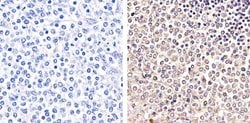 Invitrogen Phospho-PYK2 (Tyr579, Tyr580) Polyclonal Antibody 100 &mu;L;