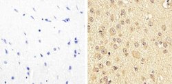 Invitrogen Phospho-PYK2 (Tyr579, Tyr580) Polyclonal Antibody 100 &mu;L;