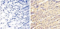 Invitrogen ERK1/ERK2 Polyclonal Antibody 100 &mu;L; Unconjugated:Antibodies,