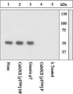 Invitrogen Phospho-CaMKII alpha (Thr286) Polyclonal Antibody 100 &mu;L | Buy Online | Invitrogen&trade; | Fisher Scientific