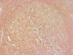 Invitrogen PARP1 (cleaved Asp214, Asp215) Polyclonal Antibody 100 &mu;L;