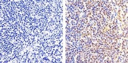 Invitrogen Phospho-NFkB p65 (Ser529) Polyclonal Antibody 100 &mu;L; Unconjugated:Antibodies,