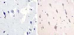 Invitrogen Phospho-Tau (Thr217) Polyclonal Antibody 100 &mu;L; Unconjugated:Antibodies,