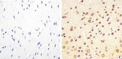 Invitrogen Phospho-Tau (Thr217) Polyclonal Antibody 100 &mu;L; Unconjugated:Antibodies,