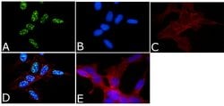 Invitrogen Phospho-Tau (Thr231) Polyclonal Antibody 100 &mu;L; Unconjugated:Antibodies,