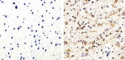Invitrogen Phospho-Tau (Thr231) Polyclonal Antibody 100 &mu;L; Unconjugated:Antibodies,