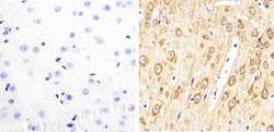 Invitrogen Phospho-Tau (Thr231) Polyclonal Antibody 100 &mu;L; Unconjugated:Antibodies,
