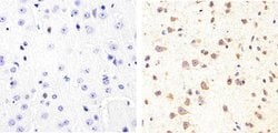 Invitrogen Phospho-Tau (Ser409) Polyclonal Antibody 100 &mu;L | Buy Online | Invitrogen&trade; | Fisher Scientific