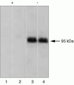 Invitrogen Phospho-IR/IGF1R (Tyr1158) Polyclonal Antibody 100 &mu;L | Buy Online | Invitrogen&trade; | Fisher Scientific