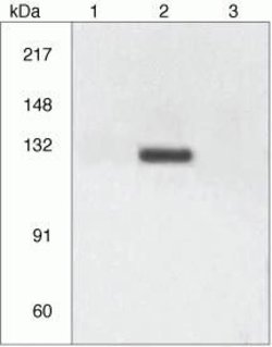 Invitrogen Phospho-CD61 (Tyr773) Polyclonal Antibody 100 &mu;L; Unconjugated:Antibodies,