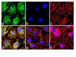 Invitrogen Phospho-NFATC2 (Ser54) Polyclonal Antibody 100 &mu;L; Unconjugated:Antibodies,