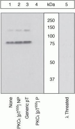 Invitrogen Phospho-PKC lambda/iota (Thr557, Thr564) Polyclonal Antibody