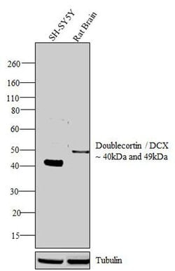Invitrogen Doublecortin Polyclonal Antibody 100 &mu;g; Unconjugated:Antibodies,