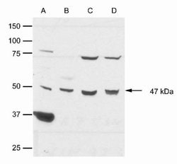Invitrogen CK1 epsilon Polyclonal Antibody 100 &mu;g; Unconjugated:Antibodies,