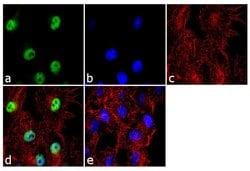 Invitrogen CK1 epsilon Polyclonal Antibody 100 &mu;g; Unconjugated:Antibodies,
