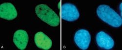 Invitrogen H3K9acK14ac Polyclonal Antibody 44 &mu;g; Unconjugated:Antibodies,