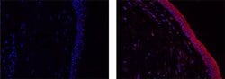 IL-38 Monoclonal Antibody (H127C), eFluor 660, eBioscience , Invitrogen:Antibodies:Primary