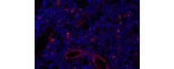 Invitrogen Cutaneous Lymphocyte Antigen (CLA) Monoclonal Antibody (HECA-452),