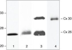 Invitrogen Connexin 26 Polyclonal Antibody 50 &mu;g; Unconjugated:Antibodies,