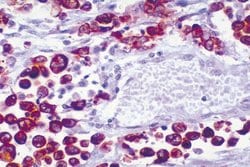 Invitrogen ALK Polyclonal Antibody 100 &mu;g; Unconjugated:Antibodies,