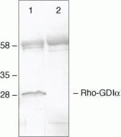 Invitrogen RhoGDI Polyclonal Antibody 100 &mu;g | Buy Online | Invitrogen&trade; | Fisher Scientific