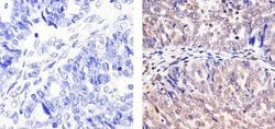Invitrogen Cullin 2 Polyclonal Antibody 100 &mu;g; Unconjugated:Antibodies,
