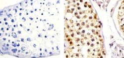 Invitrogen Cullin 2 Polyclonal Antibody 100 &mu;g; Unconjugated:Antibodies,