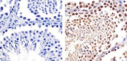 Invitrogen Cullin 2 Polyclonal Antibody 100 &mu;g; Unconjugated:Antibodies,