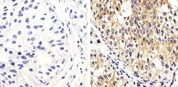 Invitrogen PTEN Polyclonal Antibody 200 &mu;g; Unconjugated:Antibodies,