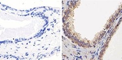 Invitrogen PTEN Polyclonal Antibody 200 &mu;g; Unconjugated:Antibodies,