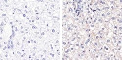 Invitrogen Connexin 26 Polyclonal Antibody 50 &mu;g; Unconjugated:Antibodies,