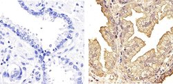 Invitrogen NFkB p50 Polyclonal Antibody 100 &mu;g; Unconjugated:Antibodies,