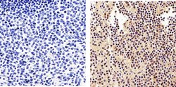 Invitrogen NFkB p50 Polyclonal Antibody 100 &mu;g; Unconjugated:Antibodies,