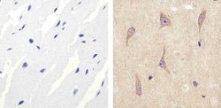 Invitrogen ALK Polyclonal Antibody 100 &mu;g; Unconjugated:Antibodies,