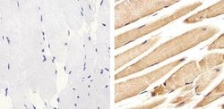 Invitrogen ALK Polyclonal Antibody 100 &mu;g; Unconjugated:Antibodies,
