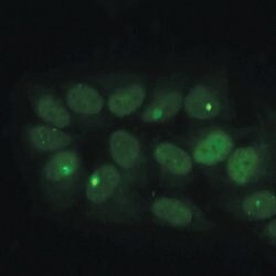 Invitrogen 53BP1 Polyclonal Antibody 100 &mu;L; Unconjugated:Antibodies,