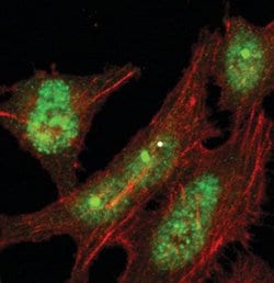 Invitrogen 53BP1 Polyclonal Antibody 100 &mu;L; Unconjugated:Antibodies,