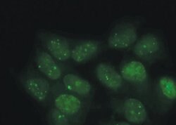 Invitrogen 53BP1 Polyclonal Antibody 100 &mu;L; Unconjugated:Antibodies,