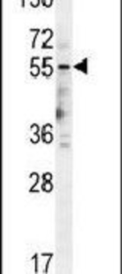 HTR3E Rabbit anti-Human, Polyclonal, Invitrogen 400 &mu;L; Unconjugated:Antibodies,