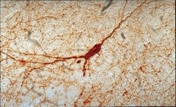 Invitrogen nNOS Polyclonal Antibody 100 &mu;g; Unconjugated:Antibodies,