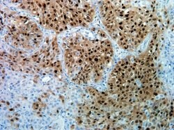 Phospho-ERK1/ERK2 (Thr185, Tyr187) Recombinant Rabbit Monoclonal Antibody