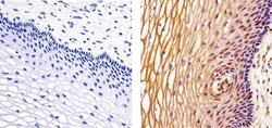 Invitrogen IRAK4 Recombinant Rabbit Monoclonal Antibody (12H2L6) 100 &mu;g | Buy Online | Invitrogen&trade; | Fisher Scientific