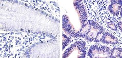 Invitrogen IRAK4 Recombinant Rabbit Monoclonal Antibody (12H2L6) 100 &mu;g | Buy Online | Invitrogen&trade; | Fisher Scientific