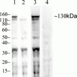 Invitrogen Phospho-JAK1 (Tyr1022, Tyr1023) Recombinant Rabbit Monoclonal